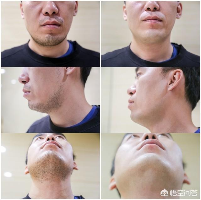 电动剃须刀哪种好（电动剃须刀哪个牌子质量好）-第17张图片