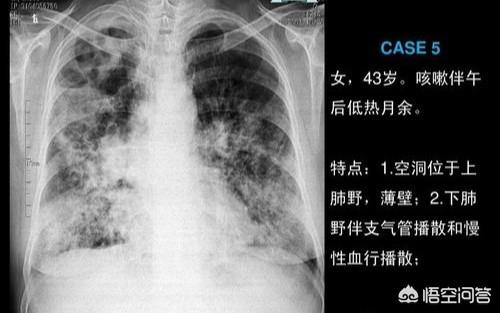 东格鲁德遗迹七个球位置图解-第1张图片
